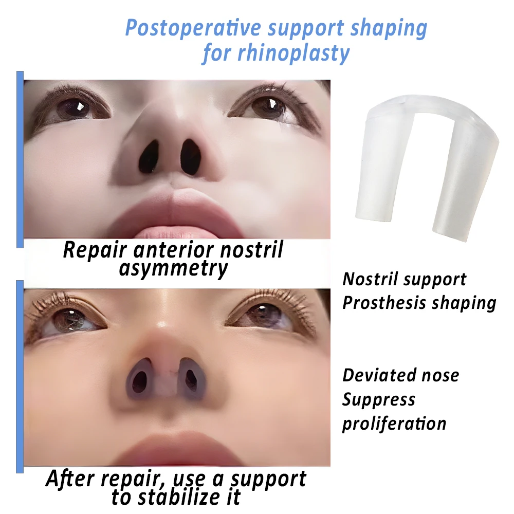 Ameliyat Sonrası Rinoplasti Bu - Anti Snore Contour Pillow incelemesi ve fiyatı